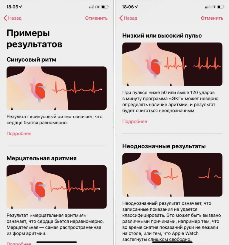 Приложение экг не доступно в вашем регионе