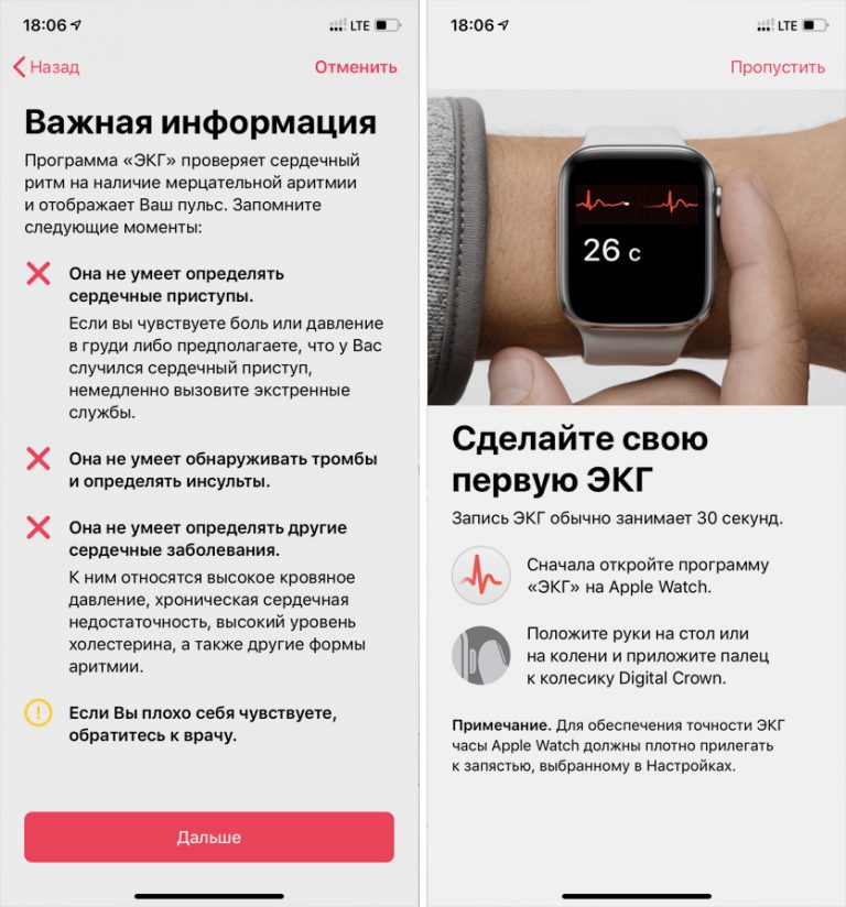 Как подключить esim на apple watch в россии