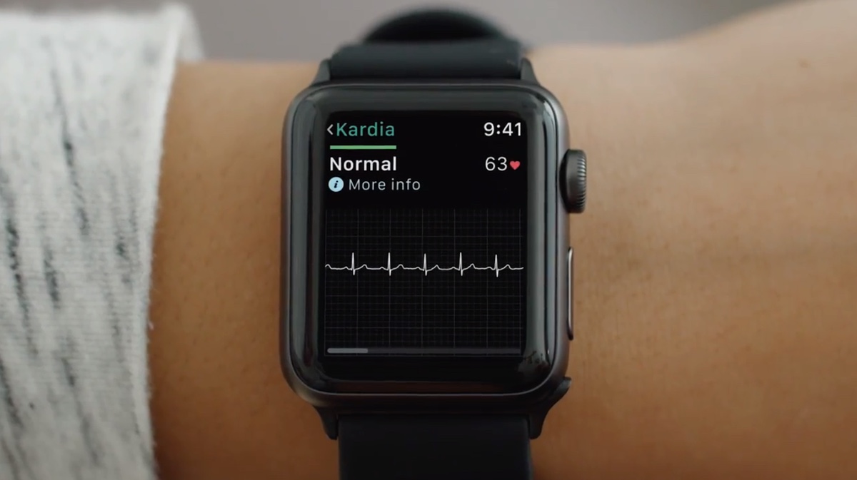 Появился новый способ включить ЭКГ на Apple Watch в России