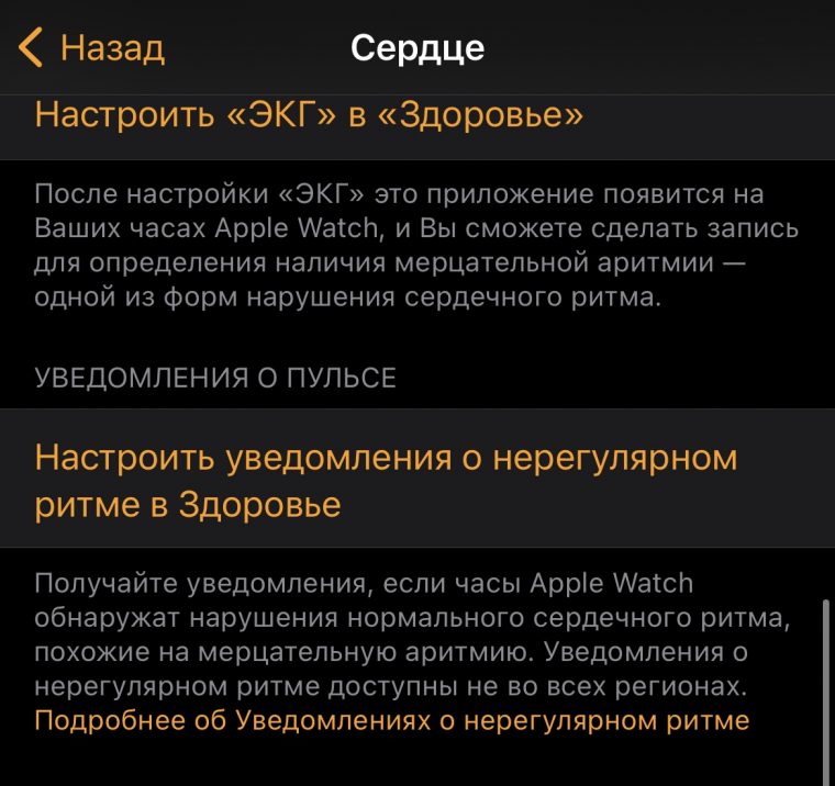 Уведомления о повышенном пульсе ios