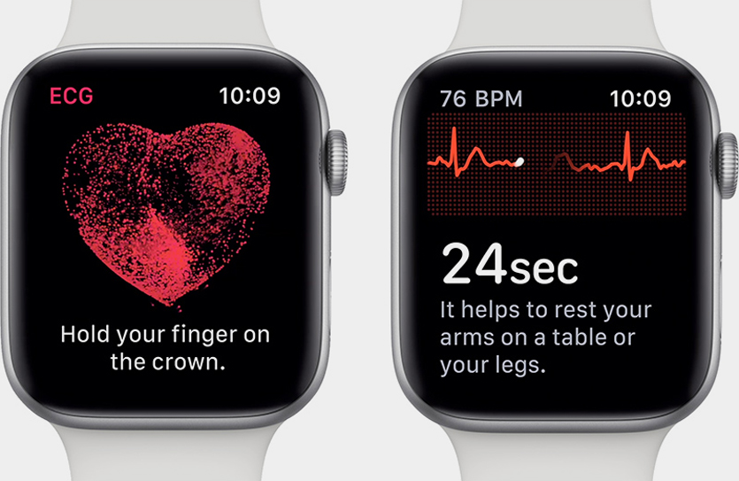 Apple Watch сообщили владельцу о проблемах с щитовидной железой за несколько месяцев до официального диагноза