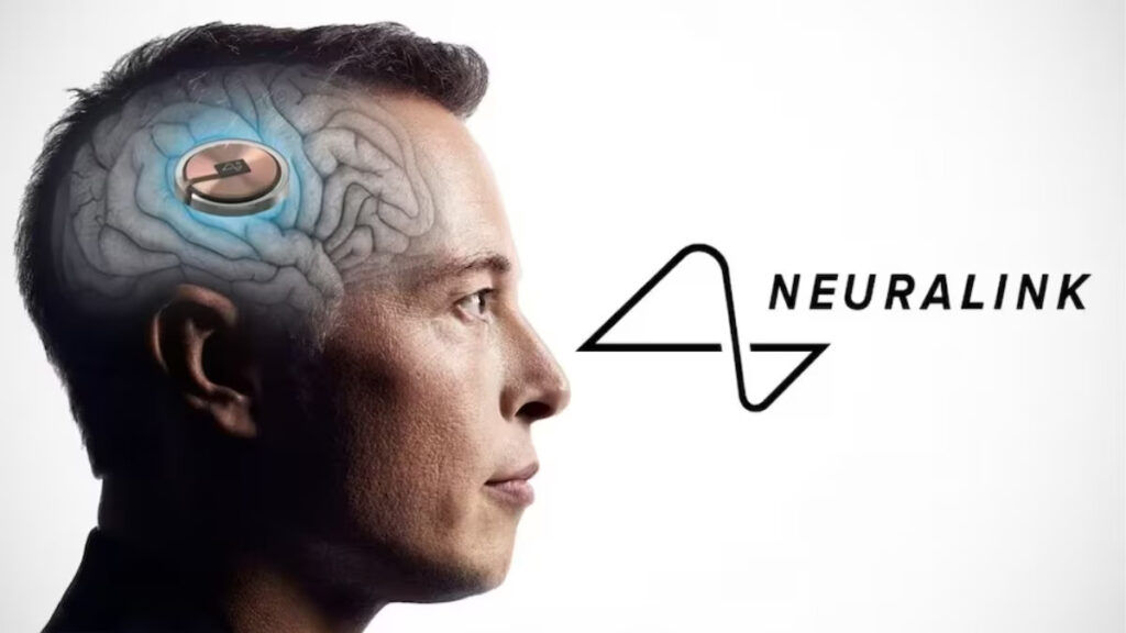 Neuralink имплантировала нейрочип уже третьему пациенту. Илон Маск заявил, что все работает хорошо